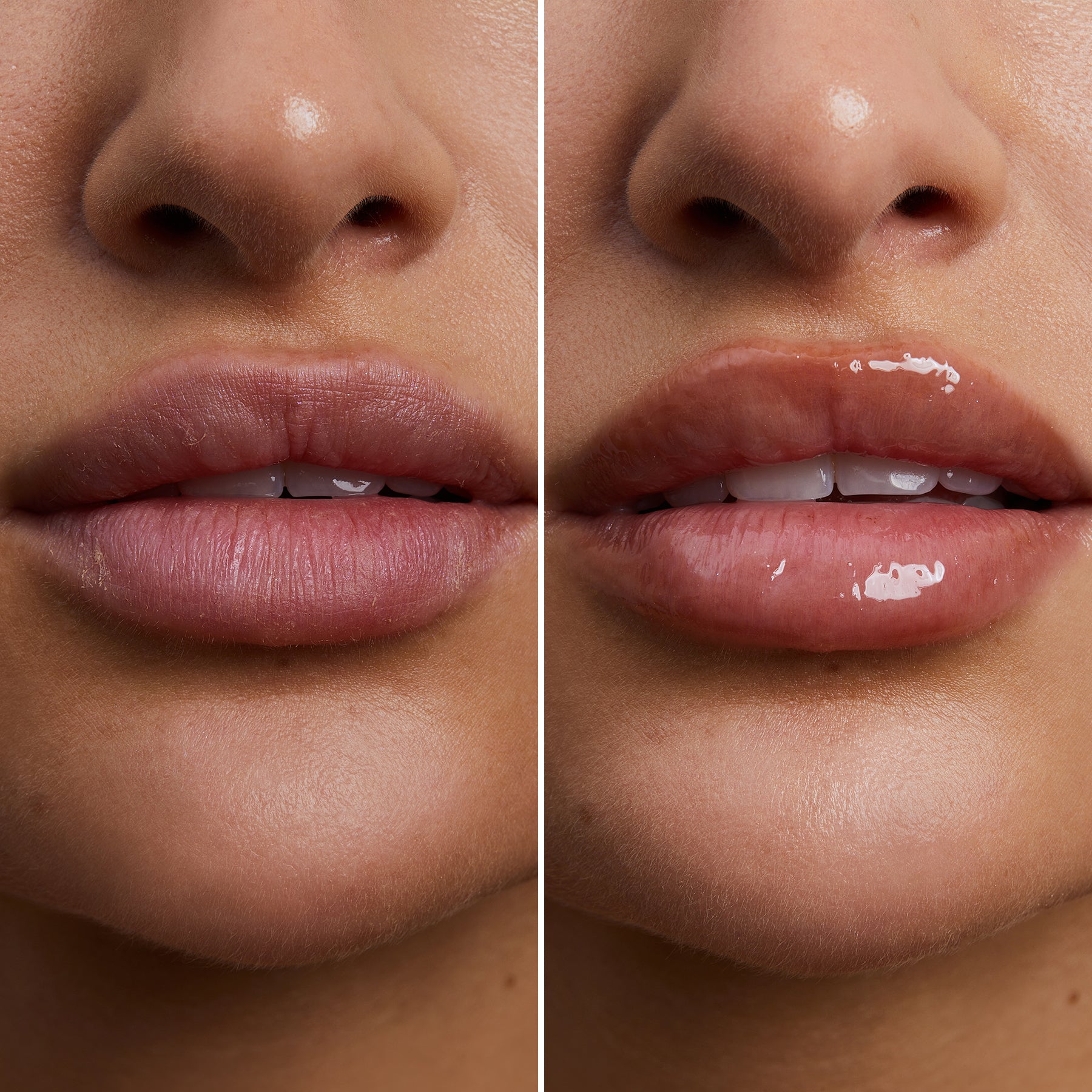 4.Lips_Before_After_1.jpg