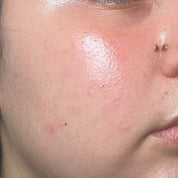 Booster | Pore Refiner Serum