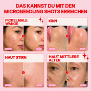Bio-Microneedling | Needless Shot Set (+ gratis Milky Toner!)