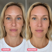 Bio-Microneedling | Needless Shot Set (+ gratis Milky Toner!)