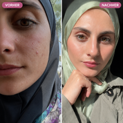 Bio-Microneedling | Needless Shot Set (+ gratis Milky Toner!)